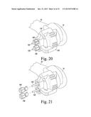 CUSTOMIZED PATIENT-SPECIFIC REVISION SURGICAL INSTRUMENTS AND METHOD diagram and image