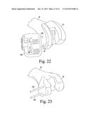 CUSTOMIZED PATIENT-SPECIFIC REVISION SURGICAL INSTRUMENTS AND METHOD diagram and image