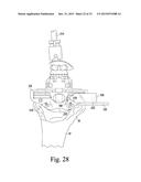 CUSTOMIZED PATIENT-SPECIFIC REVISION SURGICAL INSTRUMENTS AND METHOD diagram and image