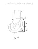 CUSTOMIZED PATIENT-SPECIFIC REVISION SURGICAL INSTRUMENTS AND METHOD diagram and image