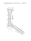 BONE FIXATION WITH A PIN AND A COLLAR diagram and image