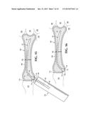 BONE FIXATION WITH A PIN AND A COLLAR diagram and image