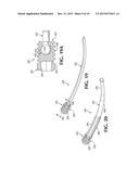 BONE FIXATION WITH A PIN AND A COLLAR diagram and image