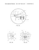 SYSTEMS AND METHODS FOR STABILIZING THE MOTION OR ADJUSTING THE POSITION     OF THE SPINE diagram and image