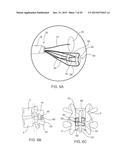 SYSTEMS AND METHODS FOR STABILIZING THE MOTION OR ADJUSTING THE POSITION     OF THE SPINE diagram and image