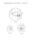 SYSTEMS AND METHODS FOR STABILIZING THE MOTION OR ADJUSTING THE POSITION     OF THE SPINE diagram and image