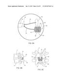 SYSTEMS AND METHODS FOR STABILIZING THE MOTION OR ADJUSTING THE POSITION     OF THE SPINE diagram and image