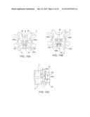 SYSTEMS AND METHODS FOR STABILIZING THE MOTION OR ADJUSTING THE POSITION     OF THE SPINE diagram and image