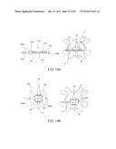 SYSTEMS AND METHODS FOR STABILIZING THE MOTION OR ADJUSTING THE POSITION     OF THE SPINE diagram and image