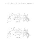 SYSTEMS AND METHODS FOR STABILIZING THE MOTION OR ADJUSTING THE POSITION     OF THE SPINE diagram and image