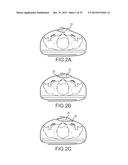 SURGICAL DRAPE WITH SEPARABLE ELEMENTS diagram and image