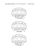 SURGICAL DRAPE WITH SEPARABLE ELEMENTS diagram and image