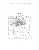 CRANIAL ALIGNMENT DEVICE FOR USE IN INTRACRANIAL STEREOTACTIC SURGERY diagram and image