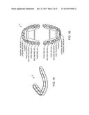 SYSTEM AND METHOD FOR TEETH CLEANING diagram and image