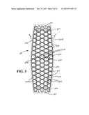 Mosaic Implants, Kits and Methods for Correcting Bone Defects diagram and image