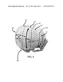 Mosaic Implants, Kits and Methods for Correcting Bone Defects diagram and image