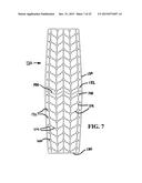 Mosaic Implants, Kits and Methods for Correcting Bone Defects diagram and image