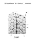 Mosaic Implants, Kits and Methods for Correcting Bone Defects diagram and image