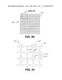 Mosaic Implants, Kits and Methods for Correcting Bone Defects diagram and image