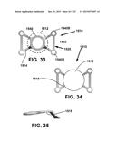 Mosaic Implants, Kits and Methods for Correcting Bone Defects diagram and image