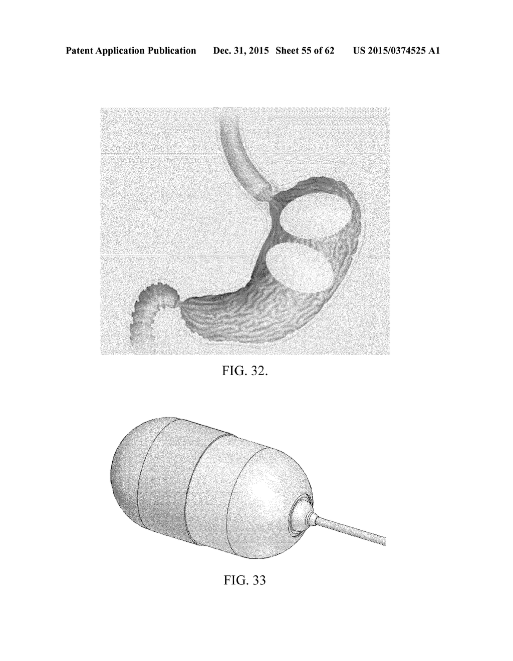 INTRAGASTRIC DEVICE - diagram, schematic, and image 56