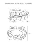 ORAL DEVICES, KITS AND METHODS FOR REDUCING SLEEP APNEA, SNORING, AND/OR     NASAL DRAINAGE diagram and image