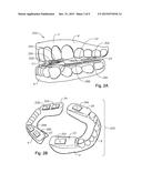 ORAL DEVICES, KITS AND METHODS FOR REDUCING SLEEP APNEA, SNORING, AND/OR     NASAL DRAINAGE diagram and image