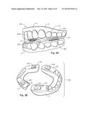 ORAL DEVICES, KITS AND METHODS FOR REDUCING SLEEP APNEA, SNORING, AND/OR     NASAL DRAINAGE diagram and image