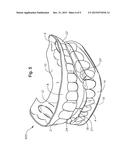 ORAL DEVICES, KITS AND METHODS FOR REDUCING SLEEP APNEA, SNORING, AND/OR     NASAL DRAINAGE diagram and image