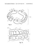 ORAL DEVICES, KITS AND METHODS FOR REDUCING SLEEP APNEA, SNORING, AND/OR     NASAL DRAINAGE diagram and image