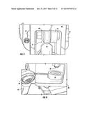 Orthosis Machine diagram and image