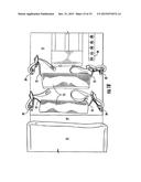 Orthosis Machine diagram and image