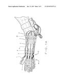 ACTUATED GLOVE ORTHOSIS AND RELATED METHODS diagram and image