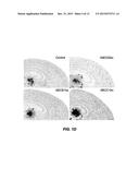 2-(R2-THIO)-10-[3-(4-R1-PIPERAZIN-1-YL)PROPYL]-10H-PHENOTHIAZINESFOR     TREATING A B-AMYLOIDOPATHY OR AN A-SYNUCLEOPATHY, ANDMETHOD FOR THE     DIAGNOSIS OR PREDIAGNOSIS THEREOF diagram and image