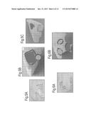 Solid Substrates for Mitigating or Preventing Cell and Tissue Adhesion and     Vascularization diagram and image