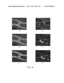 COATINGS WITH CRYSTALLIZED ACTIVE AGENT(S) AND METHODS diagram and image