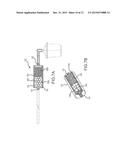 TISSUE PARCELIZATION METHOD AND APPARATUS diagram and image