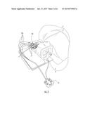 MRI-Compatible Surgical Cannulae for Transferring a Substance to and/or     from a Patient diagram and image