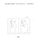 MRI-Compatible Surgical Cannulae for Transferring a Substance to and/or     from a Patient diagram and image