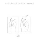 MRI-Compatible Surgical Cannulae for Transferring a Substance to and/or     from a Patient diagram and image