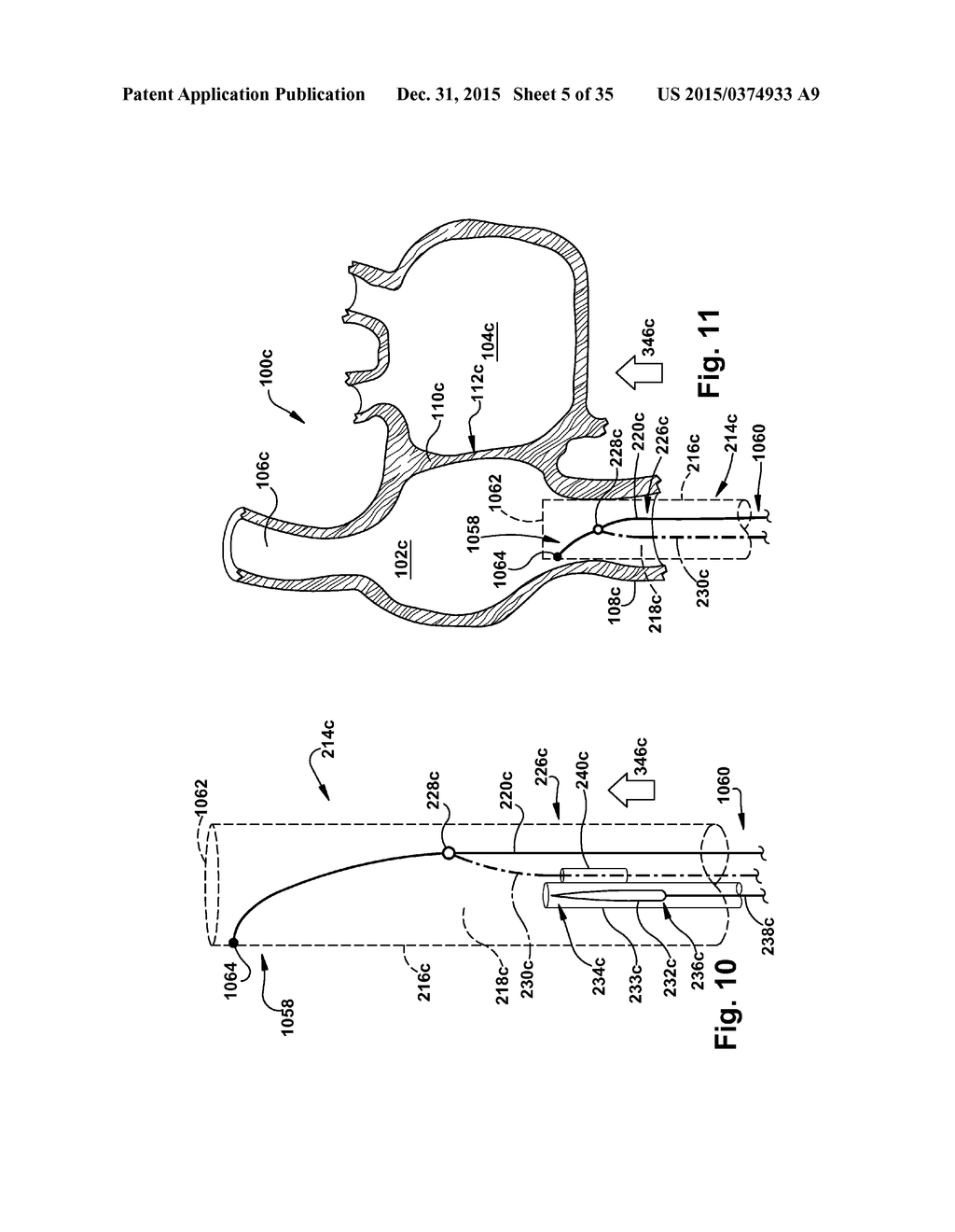 APPARATUS AND METHOD FOR TARGETING A BODY TISSUE - diagram, schematic, and image 06