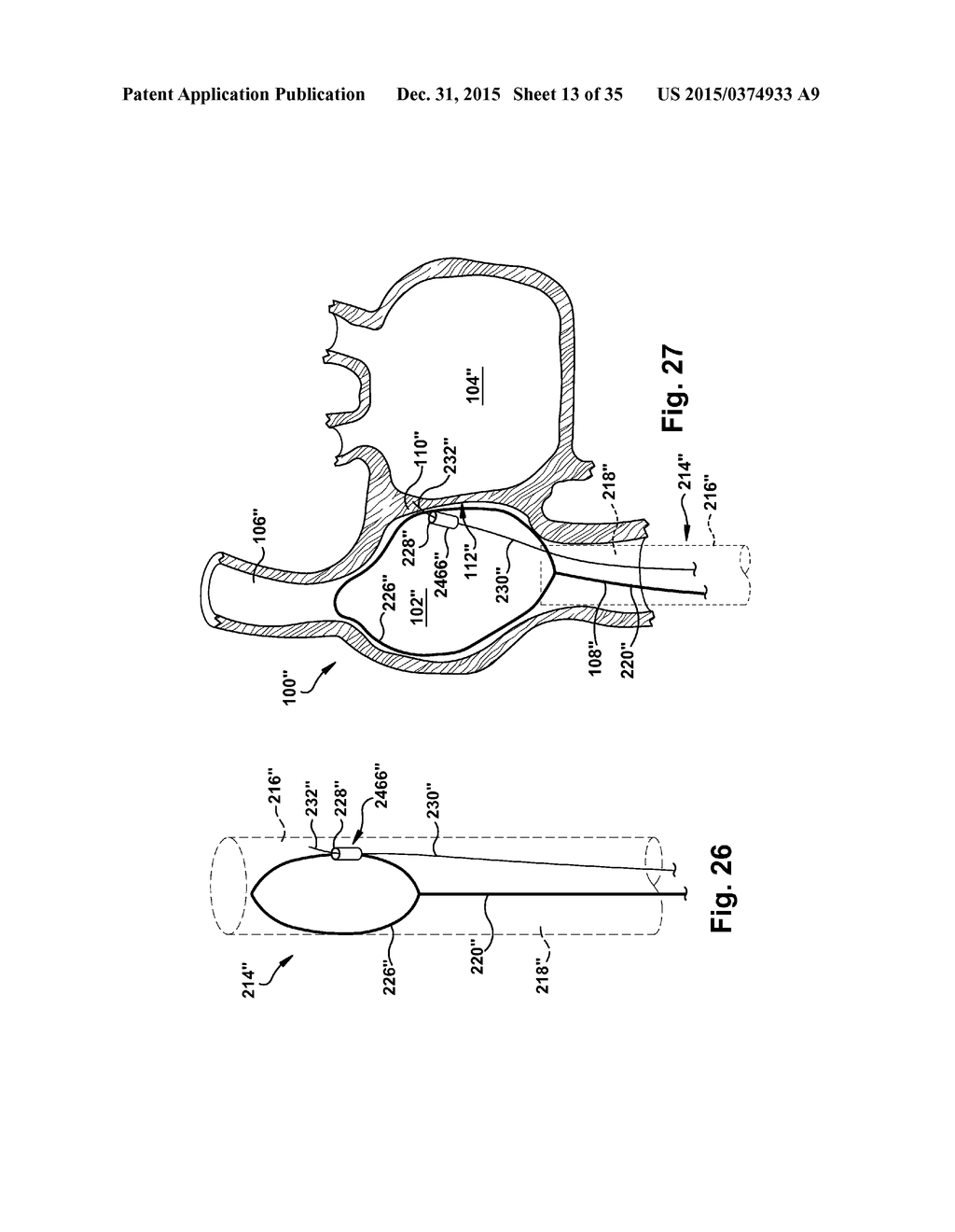 APPARATUS AND METHOD FOR TARGETING A BODY TISSUE - diagram, schematic, and image 14