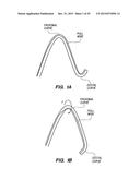 METHOD OF ANCHORING PULLWIRE DIRECTLY ARTICULATABLE REGION IN CATHETER diagram and image