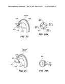 METHOD OF ANCHORING PULLWIRE DIRECTLY ARTICULATABLE REGION IN CATHETER diagram and image