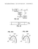 METHOD OF ANCHORING PULLWIRE DIRECTLY ARTICULATABLE REGION IN CATHETER diagram and image