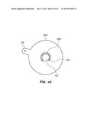 METHOD OF ANCHORING PULLWIRE DIRECTLY ARTICULATABLE REGION IN CATHETER diagram and image