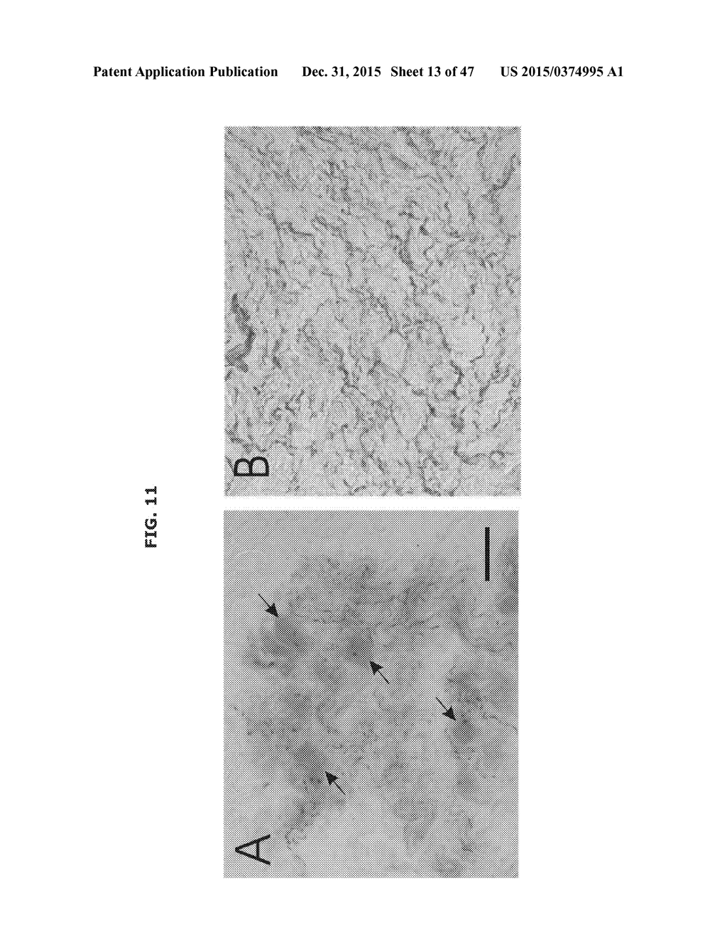 CARDIAC NEUROMODULATION AND METHODS OF USING SAME - diagram, schematic, and image 14