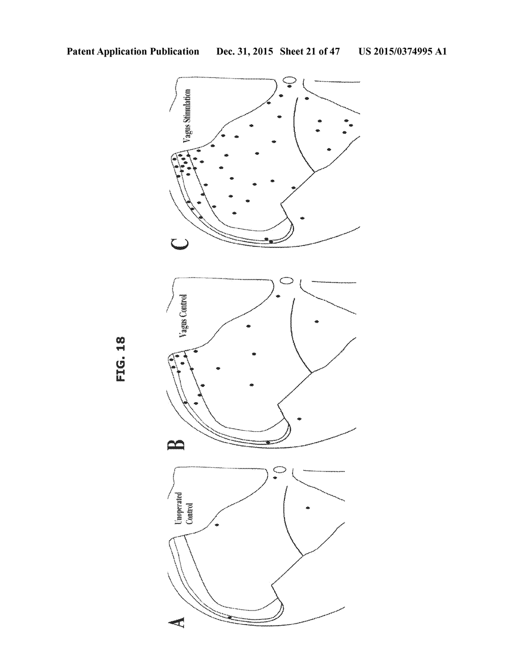 CARDIAC NEUROMODULATION AND METHODS OF USING SAME - diagram, schematic, and image 22