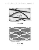 PLEATED FILTRATION MEDIA, MEDIA PACKS, FILTER ELEMENTS, AND METHODS FOR     FILTERING FLUIDS diagram and image