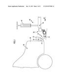 Trailer Coupling and Load Carrier Arrangement For A Trailer Coupling diagram and image